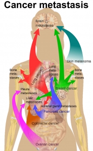 How does the body become harmed by metastatic cancer